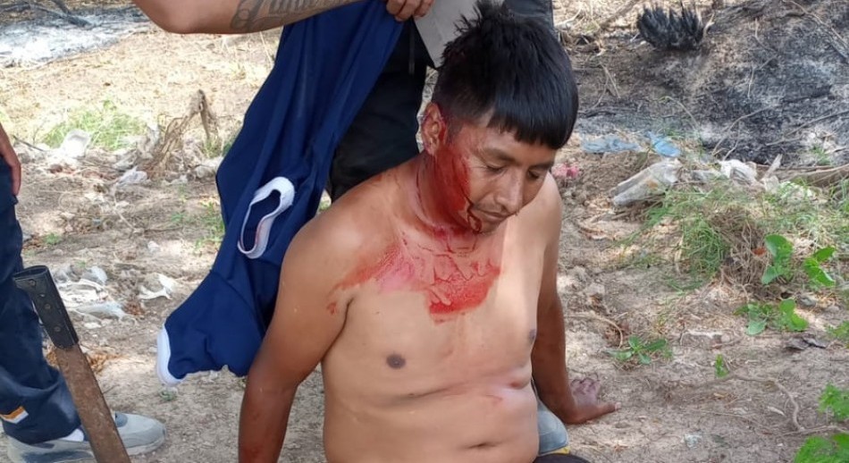 La Matanza: Cruento enfrentamiento en una toma de tierras de González Catán
